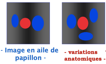 ed4cfd5692c8756144d5365b3075d622.png