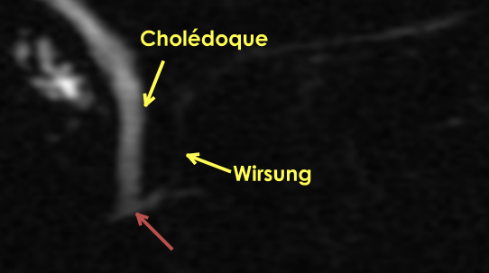f19271260a58489a9f1520a2f2aeab35.png