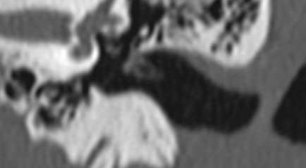 fa345334d88da653b5efa456000cd4a1.png