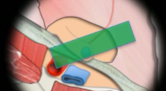 fa3a0c0ffe9f776dcc4c6ad6fd631895.png