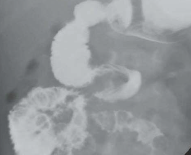 fc1dfc60da7f3616127a4659762e2a09.png