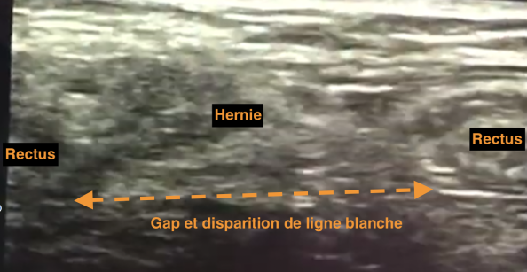 fea1a9937209833c66a344d2c596988d.png